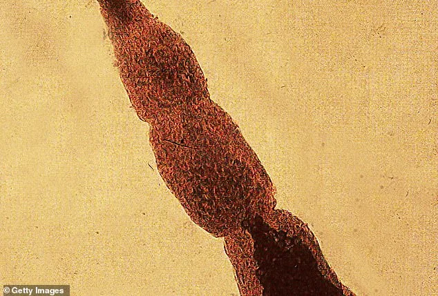 Fox Tapeworm Spreads to Washington State: Emerging Health Threat in North America