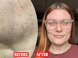 Aida Azizii's Remarkable Journey: Overcoming PCOS and Transforming from Size 22 to 10