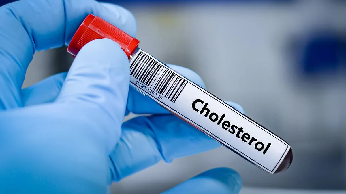 Groundbreaking Study Reveals High Street Cholesterol Test Outperforms GPs in Predicting Heart Risks, Sparking Reevaluation of Cardiovascular Assessments
