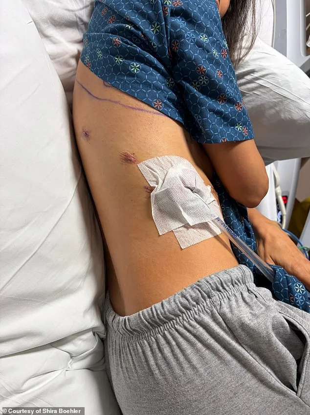 Lung Cancer's Alarming Shift: Young, Healthy Non-Smokers Now at Risk