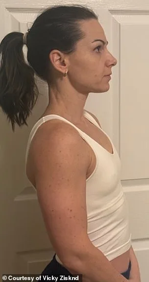 Revolutionary Minimally Invasive Breast Augmentation: Instant Results, No Scars, and Natural Beauty