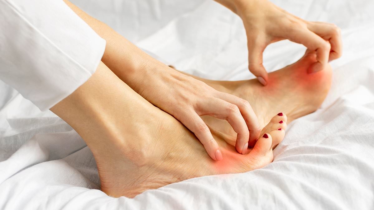 Rising athlete's foot cases in Britain now pose serious health risks.