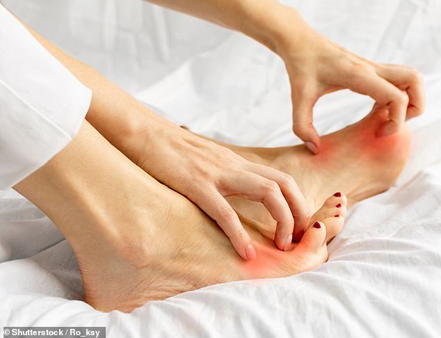 Rising athlete's foot cases in Britain now pose serious health risks.