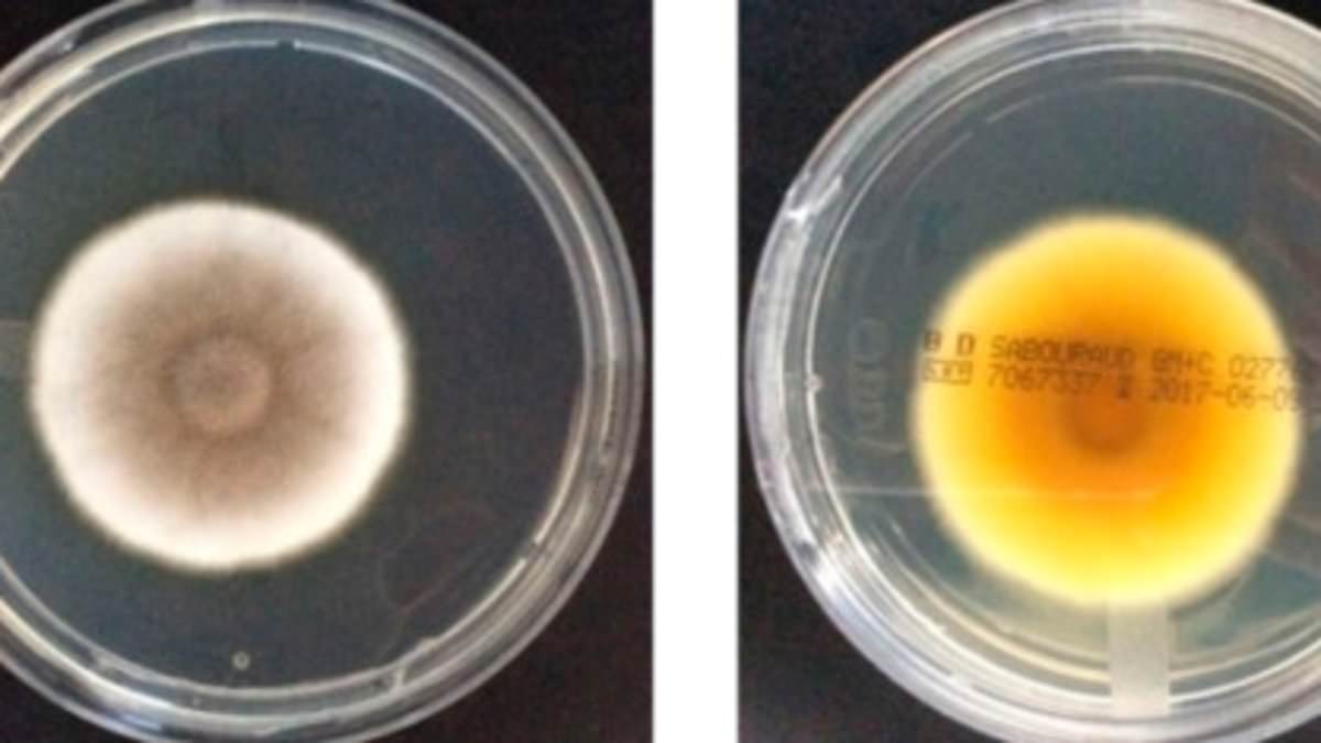 Resilient Aspergillus Fungus Survives Mars Conditions and NASA Cleanrooms