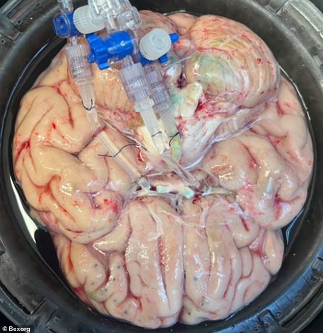 Connecticut startup tests drugs on suspended human neural tissue.
