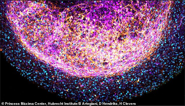 Connecticut startup tests drugs on suspended human neural tissue.